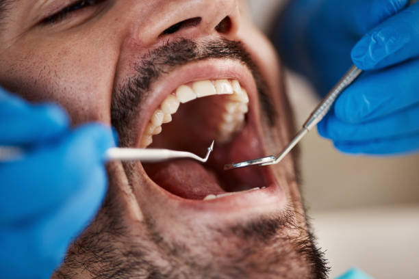 Best Cracked Tooth Emergency Dentist  in Viera West, FL